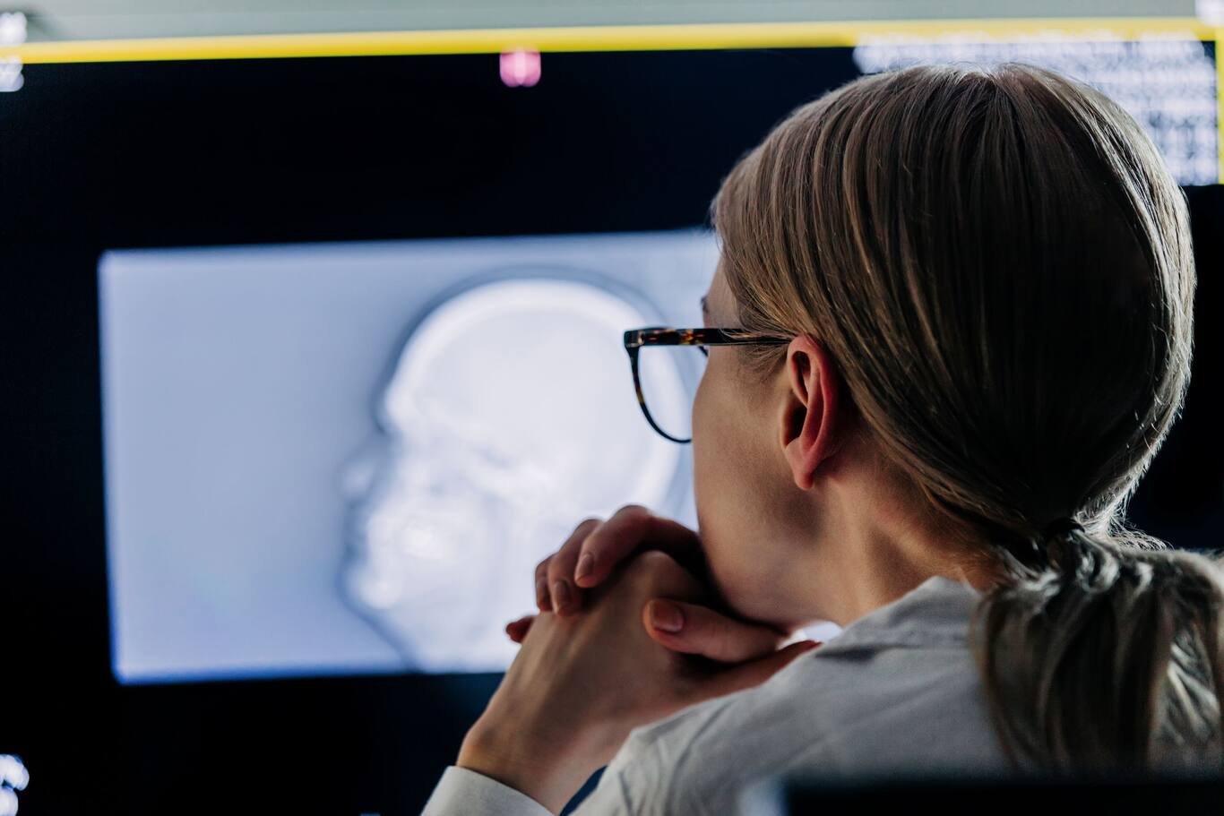 Lekár analyzuje CT snímku mozgu na monitore v nemocnici